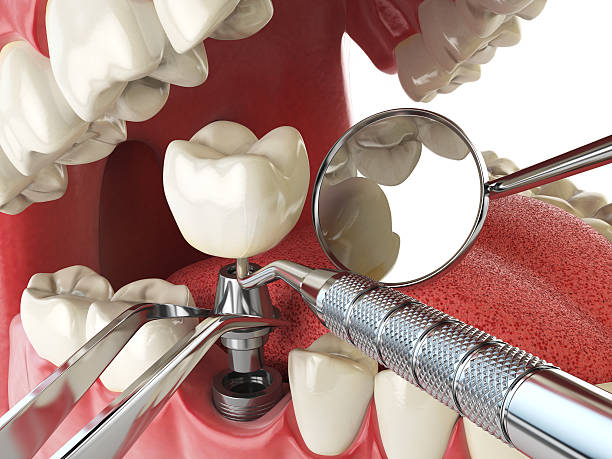 Best Walk-In Emergency Dentist in East Lake, FL